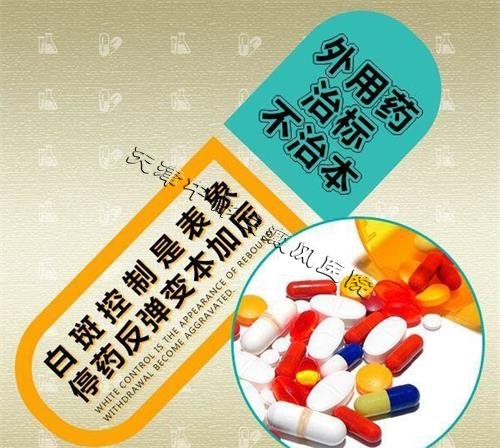 白癜风患处发痒我们可以用哪些方法缓解