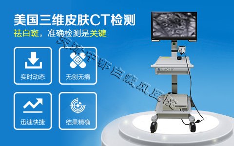 儿童白癜风症状有哪些呢？